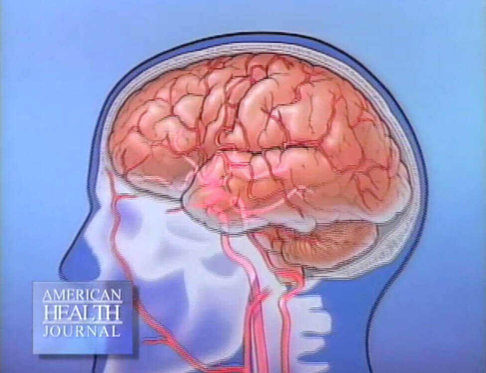 Blood Vessels Feeding Into the Brain