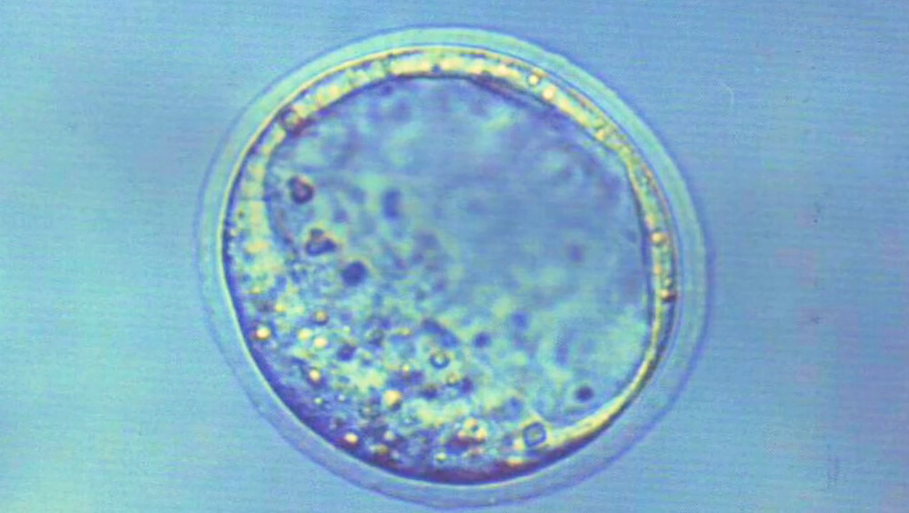 Human Stem Cell Under Microscope