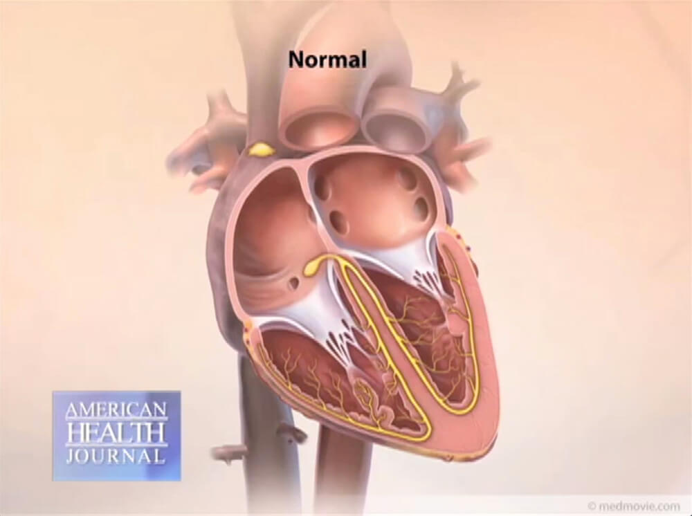 Diagram of Normal Heart Interior