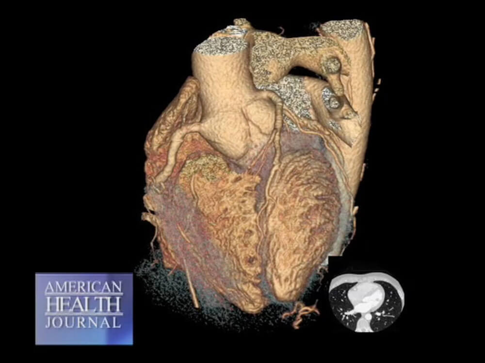 Damaged Heart with Blockages